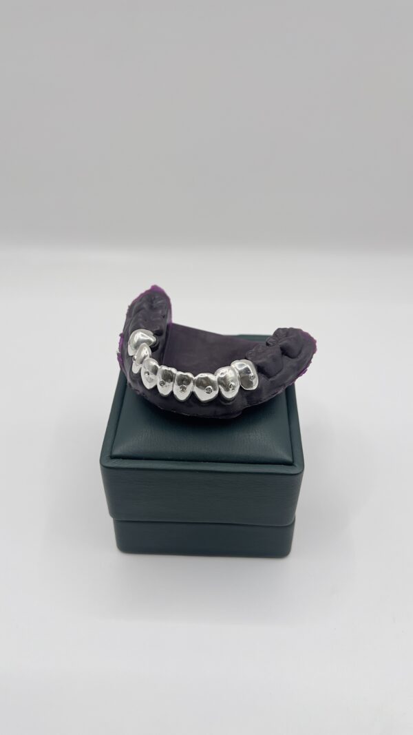 Grillz en plata con diamantes de laboratorio, vista lateral